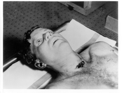 kennedy autopsy. JFK Autopsy Photo